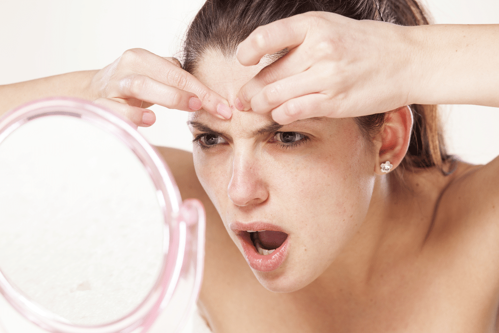 Top Remedies For Acne