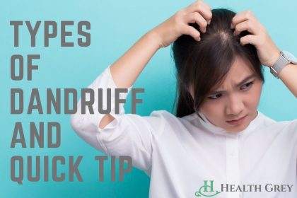 Different Types of Dandruff
