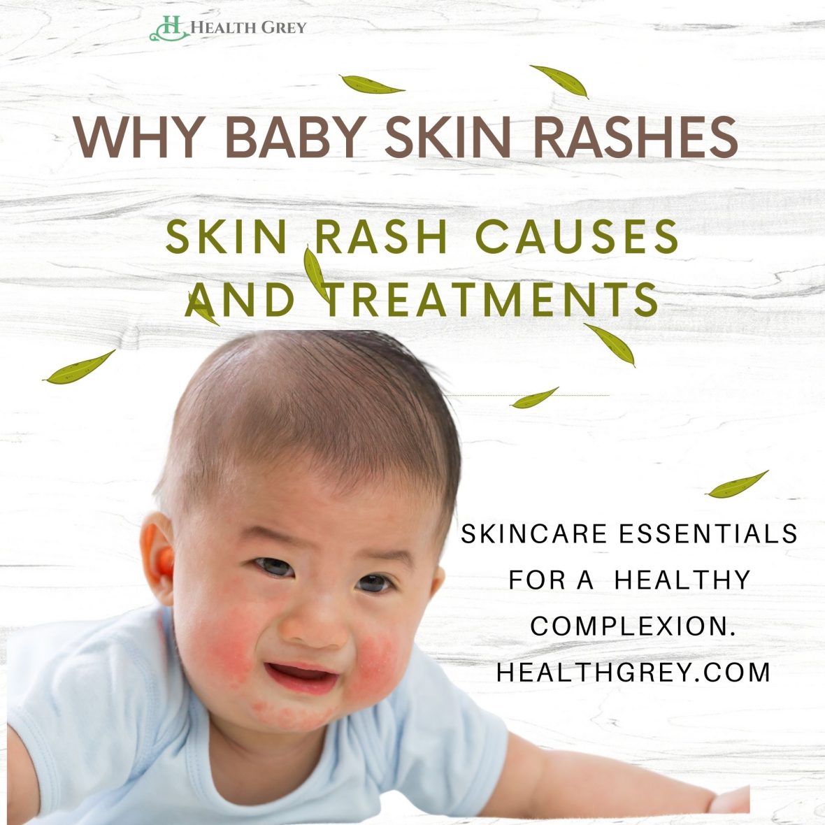 Why baby skin rashes