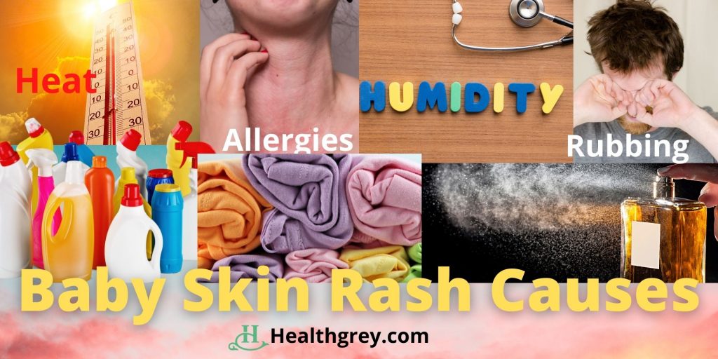 Baby skin rash causes