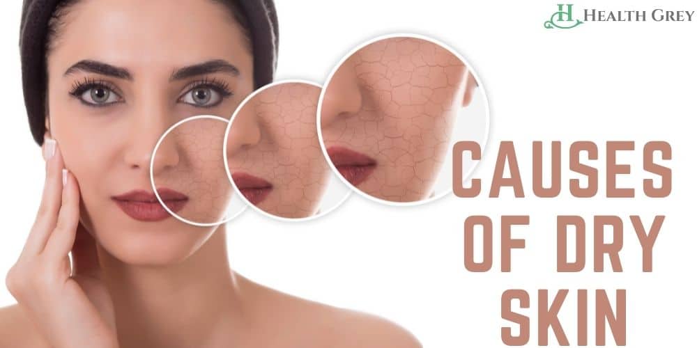 5 Causes Risks And Prevention Of Dry Skin Across The Body Health Grey 