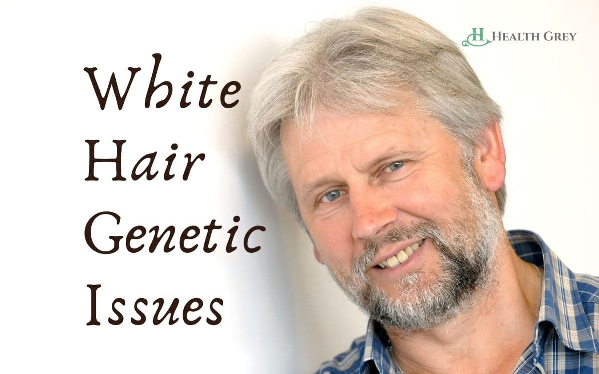 A man with white hair Genetic issues