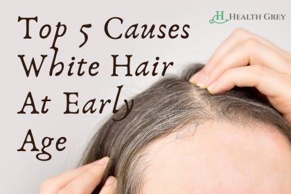 Top 5 Causes White Hair At Early Age