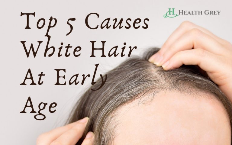 top-5-causes-white-hair-at-early-age-seen-health-grey