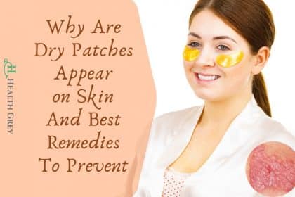 Dry Patch On Skin And Remedies To Prevent