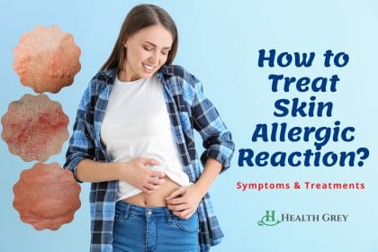 How to treat a skin allergic reaction